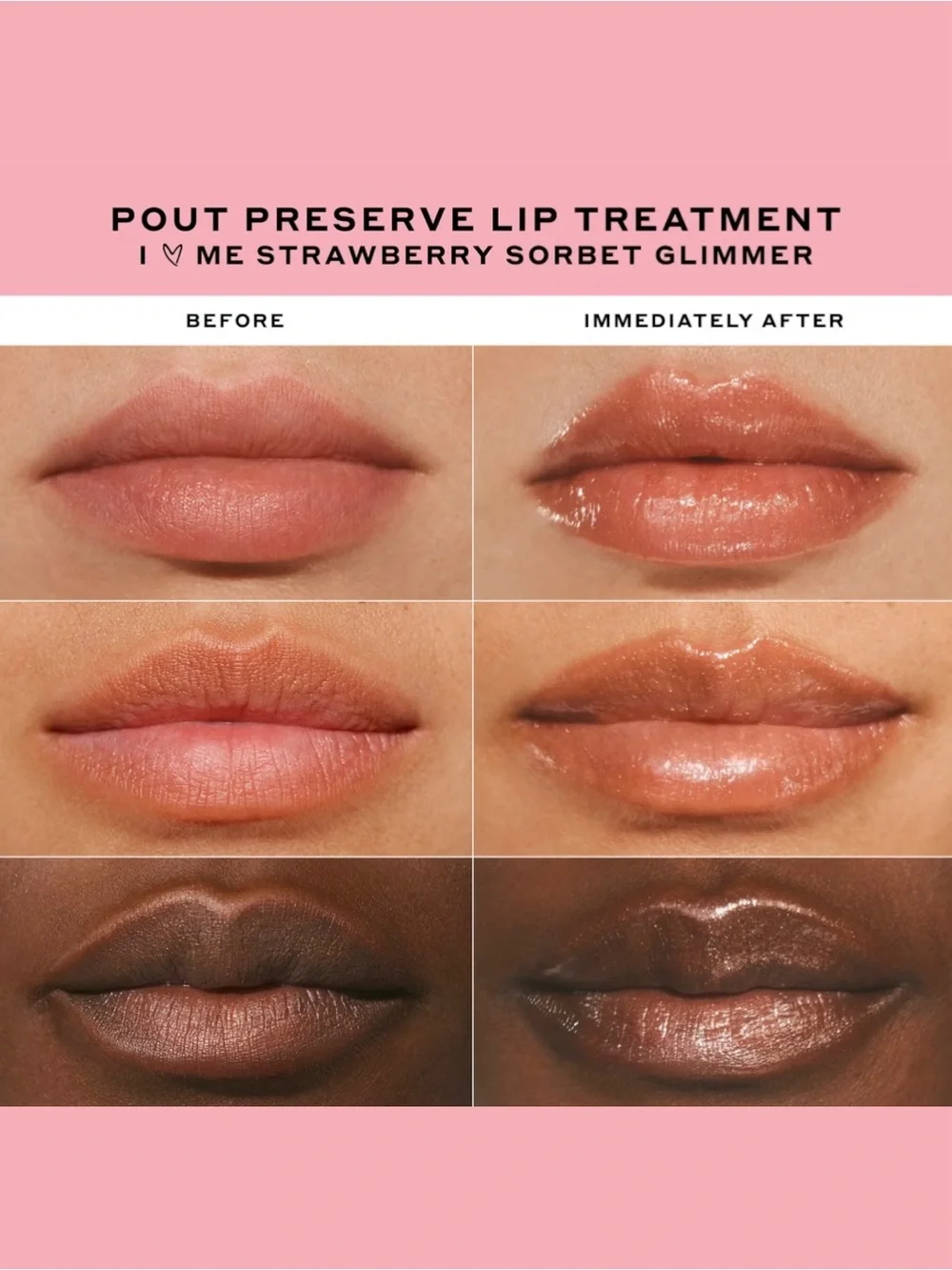 BNIB Ole Henriksen x Anine Bing I ❤️ Me Peptide Lip Treatment Limited Edition